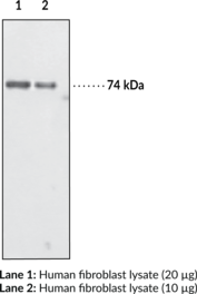 Immunogen:  Synthetic peptide from the internal region of human optineurin • Host:  rabbit • Species Reactivity: (+) Human; (−) Murine