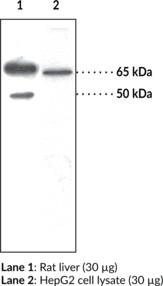 Immunogen: Synthetic peptide from the N-terminal region of human SOAT-1/ACAT-1 • Host: Rabbit • Species Reactivity: (+) Human