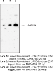 Immunogen: Recombinant human L-PGD synthase • Clone designation: 10A5 • Host: Rat • Isotype IgG1κ • Species Reactivity: (+) Human and mouse • Applications: IHC and WB