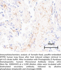 Antigen:  Recombinant human H-PGDS • Host:  mouse