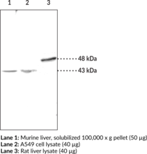 Immunogen: Synthetic peptide from the C-terminal cytoplasmic region of human protein LPA1 • Host:  Rabbit • Species Reactivity: (+) Human