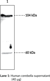 Immunogen: Peptide from the C-terminal region of rat lysoPLD • Host: Rabbit  • Species Reactivity: (+) Human