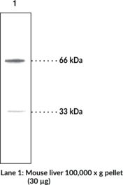 Immunogen: Synthetic peptide from the C-terminal region of human PINK1 • Host: Rabbit • Species Reactivity: (+) Human