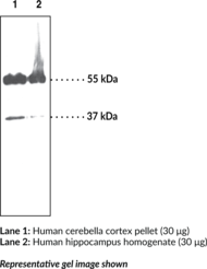 Immunogen: Synthetic peptide from the N-terminal region of mouse protein MC4R • Host: Rabbit • Species Reactivity: (+) Human