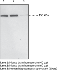 Immunogen: Synthetic peptide from the C-terminal region of human PHLPP1 (β isoform) • Host: Rabbit • Cross Reactivity: (+) PHLPP1α