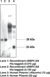 Antigen:  human sRBP4 amino acids 28-37 (RVKENFDKAR) · Host:  rabbit · Cross-reactivity:  (+) human sRBP4; other species not tested · Application:  WB • sRBP4 binds one equivalent of vitamin A and is one of the major retinol carriers found in the blood of mammals. It is an adipocyte-derived “signal” whose elevation causes systemic insulin resistance whereas reduction of serum concentrations improves insulin action. Thus