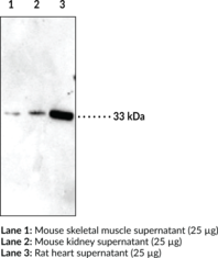 Immunogen: Synthetic peptide from the internal region of human IGFBP5 • Host: Rabbit • Species Reactivity: (+) Mouse and rat • Application: WB • IGFBP5 is a secreted protein that binds IGF-1 and restricts it from accessing its cell-surface receptor (IGF-1R). This aids in regulation of cell growth