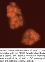 Immunogen: Synthetic peptide from an internal region of mouse PCSK9 • Host: Rabbit • Species Reactivity: (+) Human