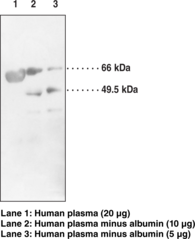 Antigen:  human LCAT protein amino acids 132-143 • Host:  rabbit • Cross Reactivity: (+) human