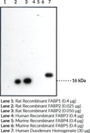 Antigen:  human FABP2 amino acids 33-40 · Host:  rabbit · Cross Reactivity: (+) human and rat FABP2; other species not tested but also expected to work with mouse and bovine;; (−) recombinant FABP1