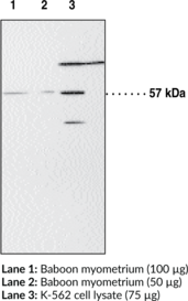 Immunogen: Synthetic peptide from the N-terminal region of human PPARα • Host: Rabbit • Species Reactivity: (+) Human