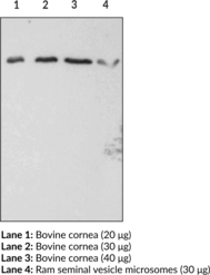 Immunogen: Synthetic peptide from the N-terminal cytoplasmic region of mouse protein FP receptor  • Host: Rabbit • Application: WB • Species reactivity: (+) Human