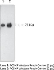 Immunogen: Purified human recombinant PCSK9 • Host: Mouse • Clone: 15A6 • Isotype:  IgG1 • Species Reactivity: (+) Human recombinant PCSK9 • Application: WB