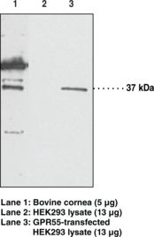Immunogen: Synthetic peptide from an internal cytoplasmic region of human GPR55 • Host: Rabbit • Species Reactivity: (+) Human and bovine • Applications: ELISA and WB • MW: 37 kDa but it may be higher due to post-translational modifications