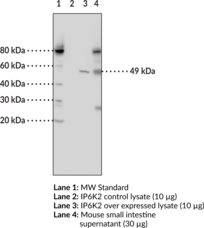 Immunogen: Human IP6K2 protein • Host: Mouse • Clone: 4F10 • Isotype: IgG2b • Species Reactivity: (+) Human • Applications: ICC and WB