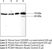 Immunogen: Purified recombinant human PCSK9 • Host: Rabbit· Species Reactivity: (+) Human