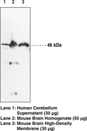 Immunogen:  peptide from the N-terminal region of human NAPE-PLD • Host:  rabbit • Species Reactivity: (+) human