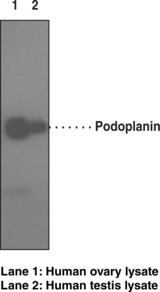 Host:  rat • Cross Reactivity: (+) human podoplanin (Clone NZ-1.2)  • Application(s): FC and WB • Podoplanin is expressed in many tumors and many normal cells