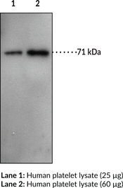 Antigen:  human PGT C-terminal amino acids 627-640 • Host:  rabbit • Cross Reactivity: (+) human