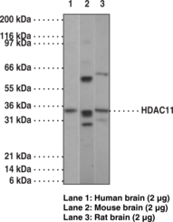 Antigen:  synthetic peptide from human HDAC11 amino acids 182-199 • Host:  rabbit • Cross Reactivity: (+) human