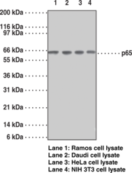 Immunogen: Peptide from the C-terminal region of human NF-κB (p65) • Host: Mouse • Species Reactivity: (+) Human