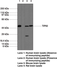Antigen:  synthetic peptide within the region of human TIP60 amino acids 480-530 • Host:  rabbit • Cross Reactivity: (+) human (isoform CRA_b)