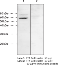 Immunogen: Human MBOAT1