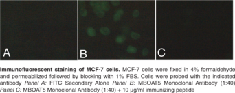 Immunogen: Synthetic peptide from the C-terminal region of human MBOAT5 • Host: Rabbit • Species Reactivity: (+) Human • Applications: FC and IF