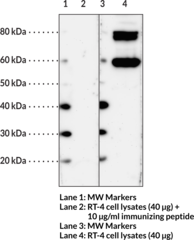 Immunogen: Synthetic peptide from the C-terminal region of human HHATL • Host: Rabbit • Species Reactivity: (+) Human HHATL • Applications: FC