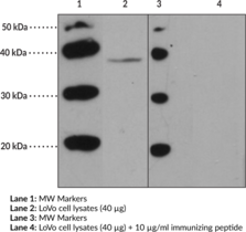 Immunogen: peptide from the internal region of human GPR43 • Host:  rabbit • Cross Reactivity: (+) human GPR43 • Application(s): FC