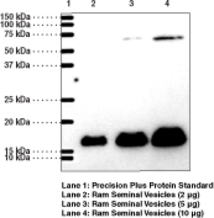 Immunogen: Peptide from the an internal region of human protein • Species-Reactivity: (+) Human