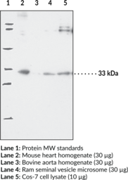 Immunogen: Synthetic peptide from the internal region of human mPGES-2 • Host: Rabbit • Species Reactivity: (+) Human