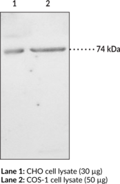 Immunogen: Synthetic peptide from an internal region of human iPLA2 (Type VI) • Host:  Rabbit • Species Reactivity : (+) Human