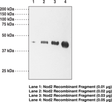 Immunogen: Recombinant protein fragment from the internal region of human Nod2 • Host: Rabbit • Species reactivity: (+) Human • Applications: WB; may not detect basal levels of Nod2 in monocytes