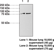 Immunogen: Peptide affinity-purified antibody • Host:  Rabbit • Species Reactivity: (+) Human