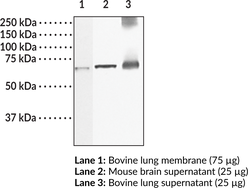 Immunogen: Synthetic peptide from an internal region of rat sGC β1 subunit • Host: Rabbit • Species Reactivity: (+) Human