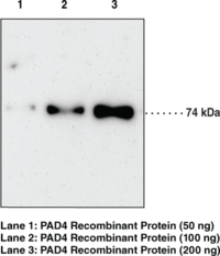 Immunogen: Full length recombinant PAD4 protein • Clone: 11F9 • Host: Mouse • Isotype: IgG1 Species Reactivity: (+) Human • Applications: ELISA