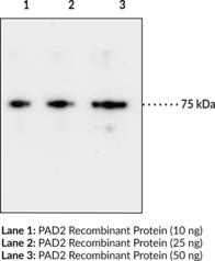 Immunogen: Full length recombinant human PAD2 protein • Clone: 9F7 • Host: Mouse • Isotype: IgG1 Species Reactivity: (+) Human • Applications: ELISA