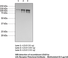 Immunogen:  Synthetic peptide from the C-terminal region of murine LDLR • Host:  Rabbit • Species Reactivity: (+) Human