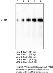 Immunogen: Recombinant human PAD1 protein • Clone designation: 6B4 • Host: Mouse • Cross Reactivity: (-) PAD2