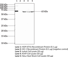 Immunogen: Human recombinant HOP • Host: Rabbit • Species reactivity: (+) Human and rat; other species not tested • Applications: ELISA