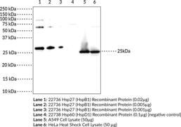 Immunogen: Human recombinant Hsp27 (HspB1) • Host: Rabbit • Species reactivity: (+) Human • Applications: ELISA