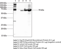 Immunogen: Human recombinant protein • Host: Rabbit • Species Reactivity: (+) Human and rat • Applications: ELISA