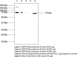 Immunogen: Human recombinant GRP78 protein (full length) • Host: Rabbit • Species reactivity: (+) Human • Applications: ELISA