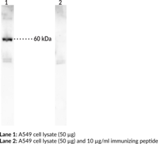 Immunogen: A synthetic peptide from the C-terminal region of human p62 • Host: Rabbit • Species Reactivity: (+) Human • Applications: ELISA and WB