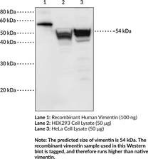Immunogen: Full-length human recombinant vimentin protein • Host: Rabbit • Species Reactivity: (+) Human • Applications: ELISA and WB