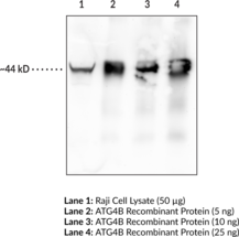 Immunogen: Full-length human recombinant ATG4B protein • Host: Mouse • Species Reactivity: Human • Cross Reactivity: (-)-ATG8 • Applications: ELISA