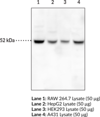 Immunogen: Full-length recombinant human Beclin 1 • Host: Mouse • Species Reactivity: (+) Human •  Applications: WB and ELISA • MW = 51.9 kDa