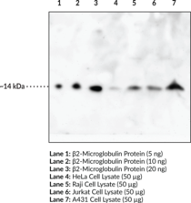 Immunogen: Human β2-microglobulin protein • Host: Rabbit • Species reactivity: (+) Human and mouse • Applications: ELISA