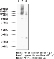 Immunogen: Peptide from the C-terminal region of the human HIF-1ɑ protein • Host: Mouse • Species Reactivity: (+) Human